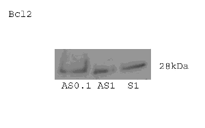 Figure 2. Representative  Western Blot of the Pro-Apoptotic Bax and Anti-Apoptotic Bcl-2 Markers in Hippocampal Tissue.