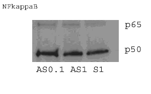 Figure 3. Representative Western Blot Analysis of Hippocampal Tissue of the Endoplasmic Reticulum and/or Inflammation Marker, NFkB.