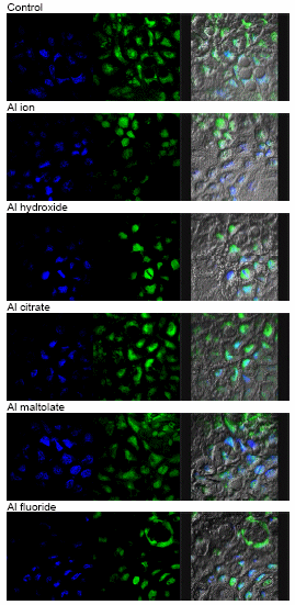 Figure 13. Confocal microscopic images of Al localization in Caco-2 cells.