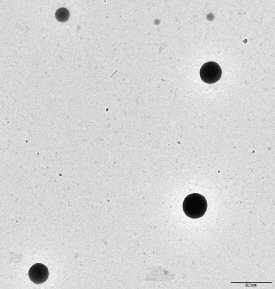 Figure 1. TEM image of shell PLA- core PU particles.