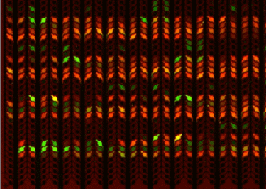 Figure 2. A Microfluidic Biochip Showing a Few Positive Spots That Are Unique to One Sample (in Green) Versus Many that are present in Other Types of Samples (Red)