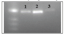Electrophoresis of cDNA Probes Hybridized With Total RNA