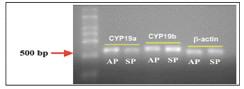 Assessment of Quality of RNA Probes Using MOPS-Formaldehyde Gel Electrophoresis