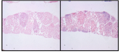 Hybridization With <em>CYP19a</em> Riboprobe, Juvenile Male Medaka: Sense Probe (left) Shows No Staining; Antisense Probe (Right) Shows Specific Staining (Purple) in the Testis. Counterstain: nuclear fast red (pink)