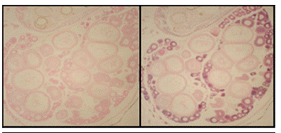 Hybridization With <em>CYP19a Probe</em>, Juvenile Female Medaka: Sense Probe (left) Shows No Staining; Antisense Probe (Right) Shows Specific Stain (Purple) in Early Stage Oocytes and Supporting Cells