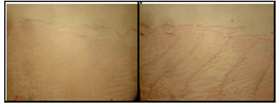 Hybridization With Beta Actin Probe, Juvenile Female Medaka: Sense Probe (Left) Shows No Staining; Antisense Probe Shows Specific Stain (Purple) in Muscle Tissue