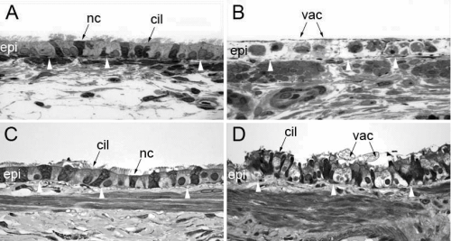 Figure 1: Histological comparison of proximal airway epithelial injury by intraperitoneal administration (A, B) and tracheal instillation (C, D) of 1-nitronaphthalene.