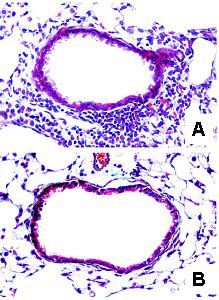 Figure  2. LPS-Induced Inflammation of the Lower Airways