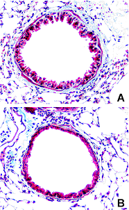 Figure 5. Masson Trichrome Staining Demonstrates an Increase in Collagen
